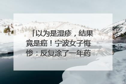 以为是湿疹，结果竟是癌！宁波女子悔惨：反复涂了一年药膏都没好！很多患者首诊都去了皮肤科